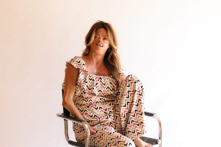 Fide Mirón, presidenta de la Asociación Española de Porfiria, llevará la voz de los pacientes a la FDA en Washington